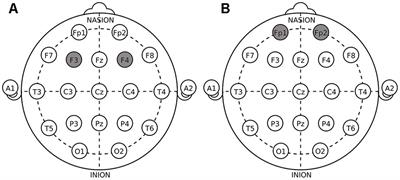 Modulating the Activity of the DLPFC and OFC Has Distinct Effects on Risk and Ambiguity Decision-Making: A tDCS Study